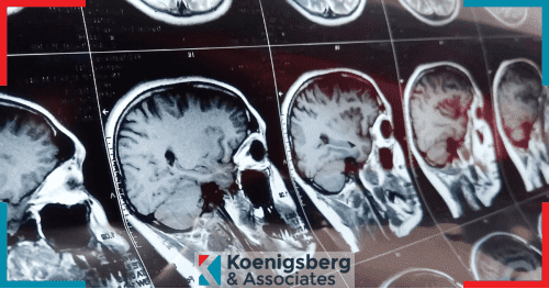 Brain scans